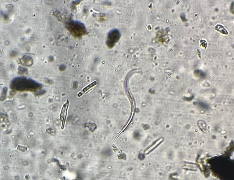 Ocean nematodes, smallest ocean worm