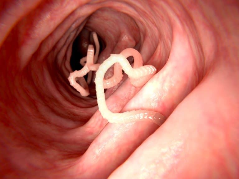 Tapeworms